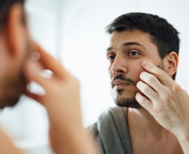تاثیر استرس بر مشکلات پوستی